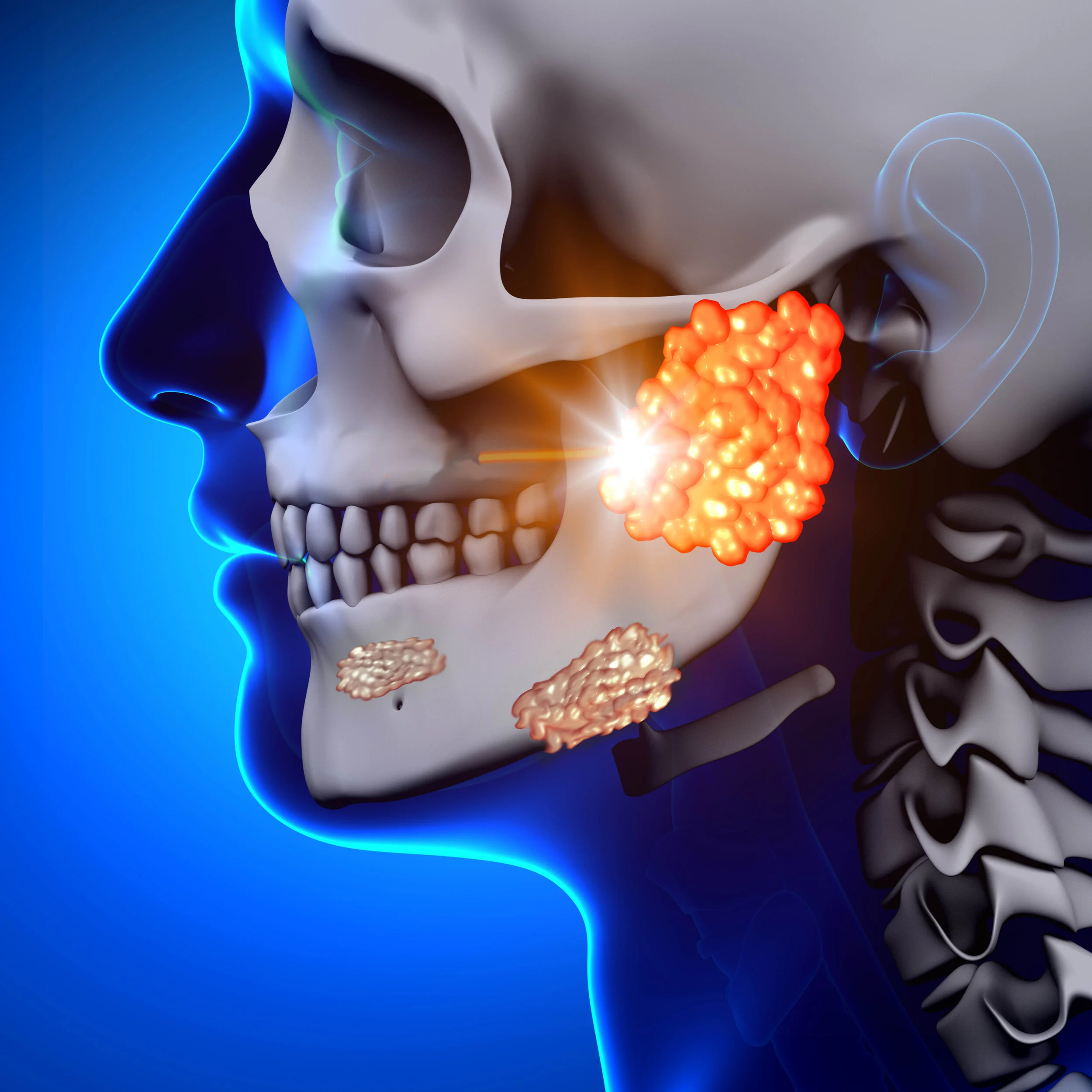 Treatments for Tumors or Growths in a salivary gland